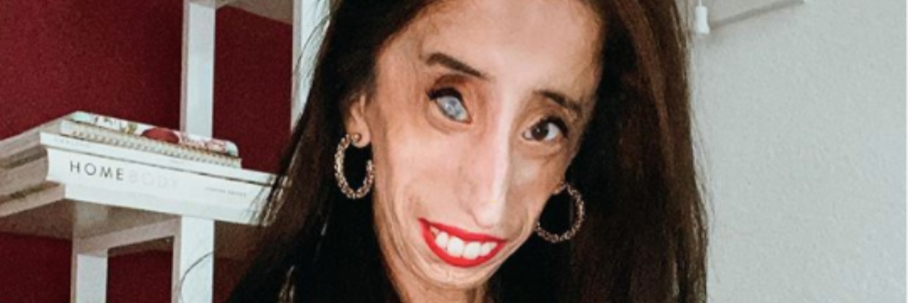 Lizzie Velasquez Speaks Out Against #FacetimePrank on TikTok Lizzie Velasquez