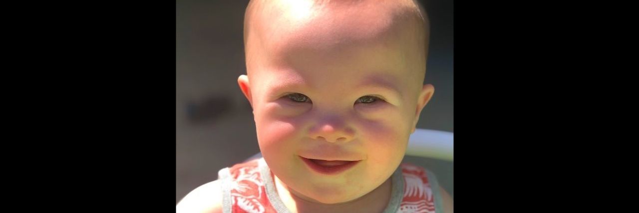 A baby with Down syndrome smiling at the camera.