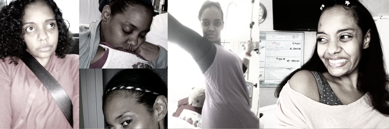 What Curing My Sickle Cell Disease Would Mean to Me