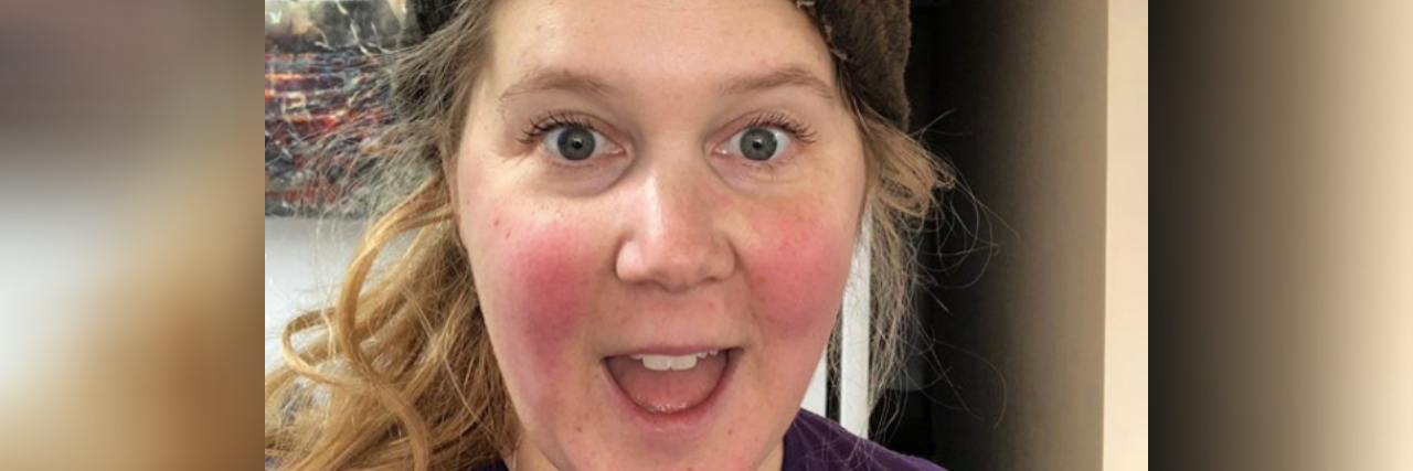 Amy Schumer Reveals Lyme Disease Diagnosis Amy Schumer wearing a brown fuzzy hat