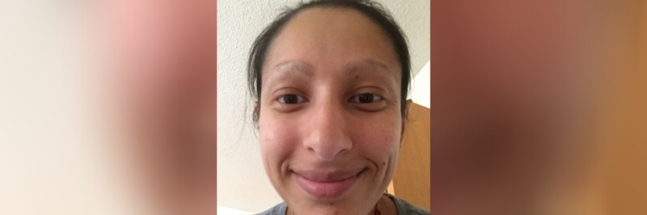 Acknowledging My Trichotillomania Helped Me Heal In this picture, Aneela Idnani of HabitAware smiles while showing off her lack of eyebrows and lashes - as a result of compulsive hair pulling.