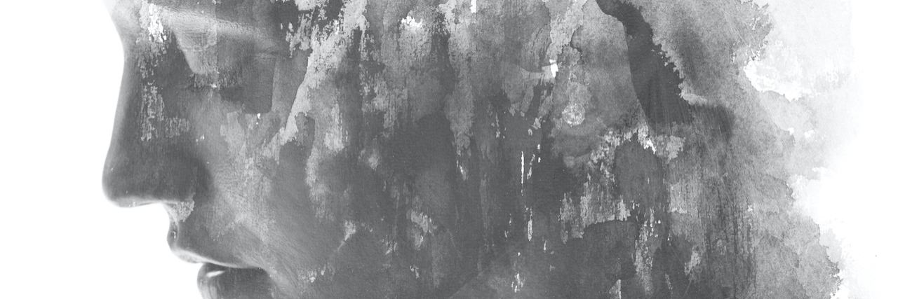 Acknowledging Medical Trauma With Crohn's Disease Profile portrait photograph of woman looking down, blended and faded into white background