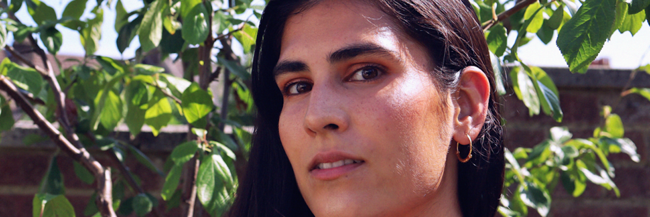 Tips for Dealing With Fear Because of a Multiple Sclerosis Diagnosis the author, standing next to a tree, looking in the camera. focus on face