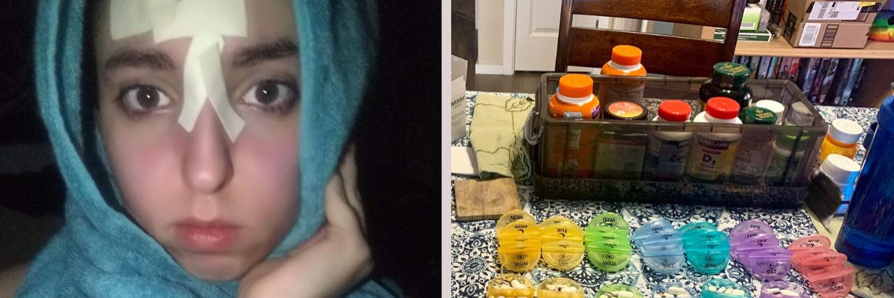 26 Photos of People Living With Chronic Illness