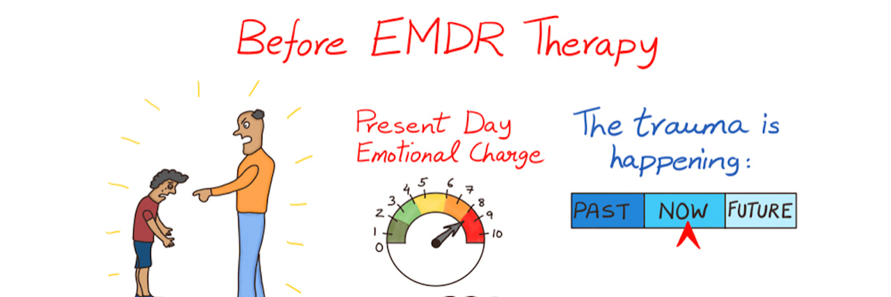 Therapy Illustrated Graphic Shows How EMDR Therapy Can Help Trauma Hand-drawn illustration showing the before and after of EMDR trauma therapy.