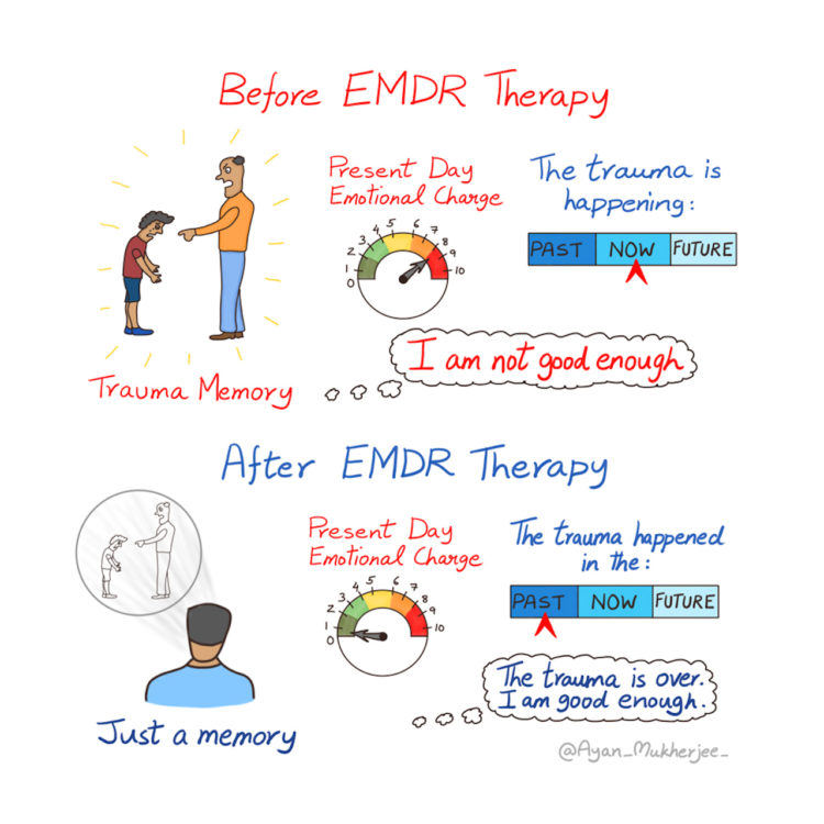 Hand-drawn illustration showing the before and after of EMDR trauma therapy. 