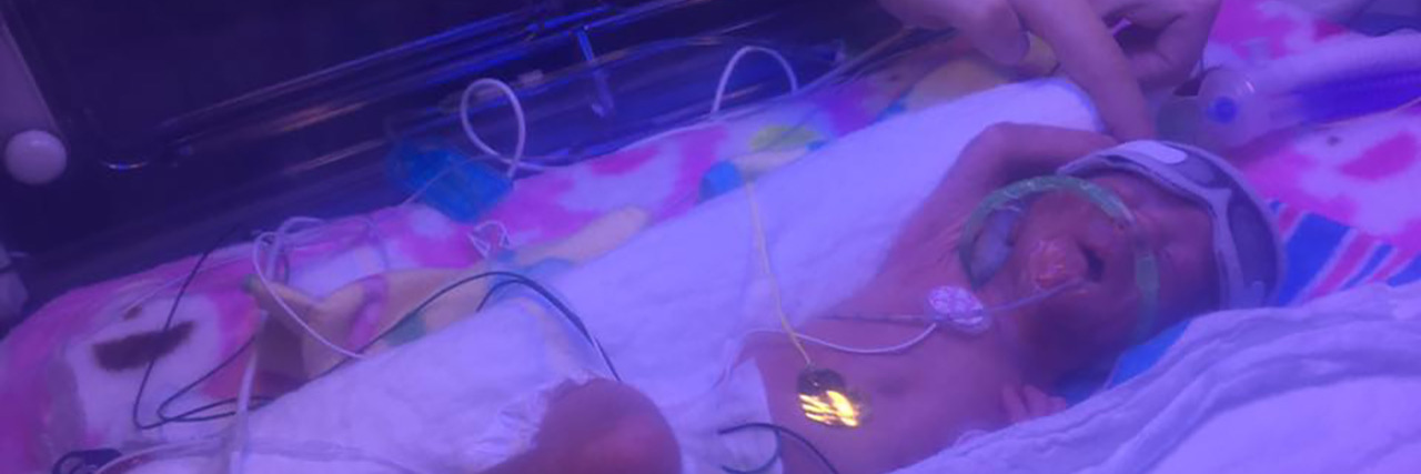 Supporting My Premature Son After His Stay in the NICU Kate touching her baby son in the NICU incubator.