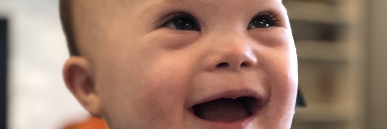 The Down Syndrome Awareness I Needed Before My Son Was Born Baby Ace smiling.