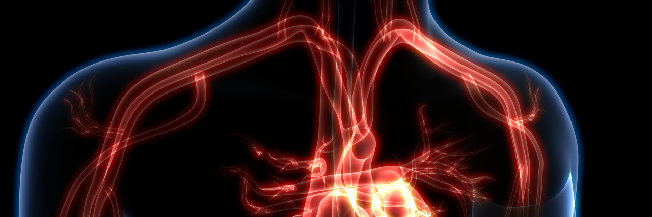 10 Things I Learned While Living With Arteriovenous Malformation 3D Illustration of Human Heart Anatomy