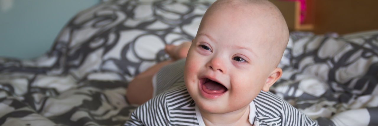 The Day I Found My Son With Down Syndrome's Biological Mother Cute baby boy with Down syndrome.