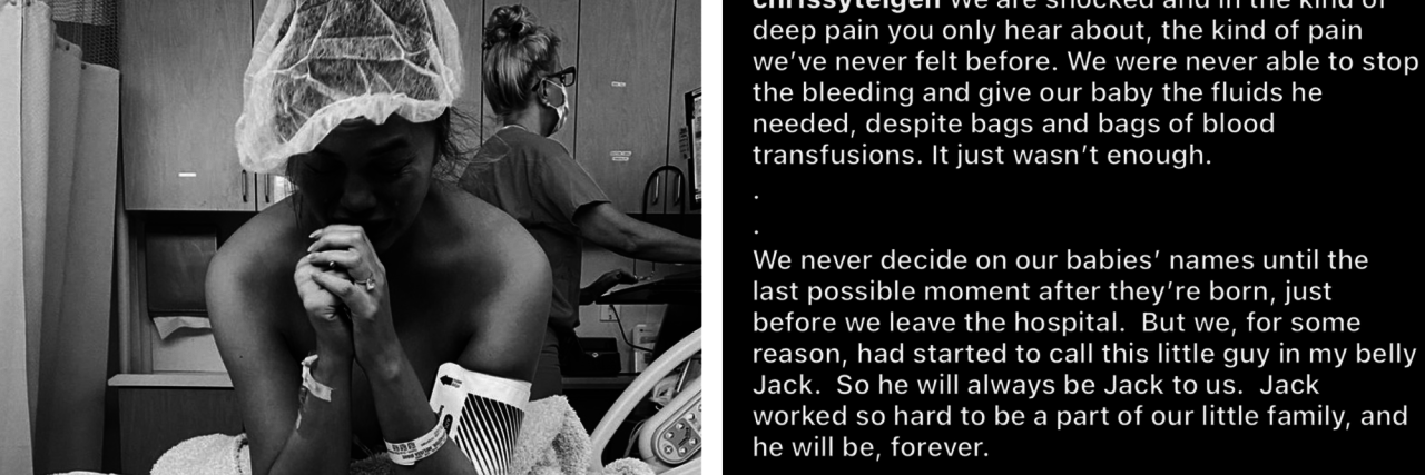 Chrissy Teigen Pens Emotional Blog Post About Miscarriage Chrissy Teigen's Instagram post detailing her miscarriage