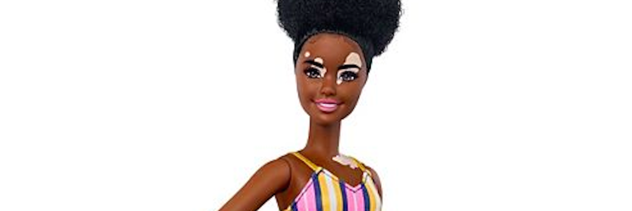 Finding Representation Living With Vitiligo image of a Barbie doll with vitiligo spots, wearing a pink and yellow dress