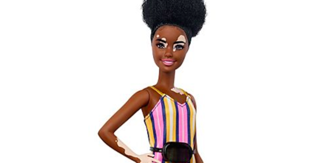 image of a Barbie doll with vitiligo spots, wearing a pink and yellow dress