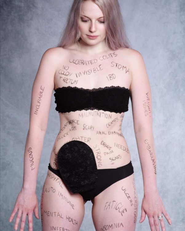 Woman with writing on her body, revealing her invisible illnesses.