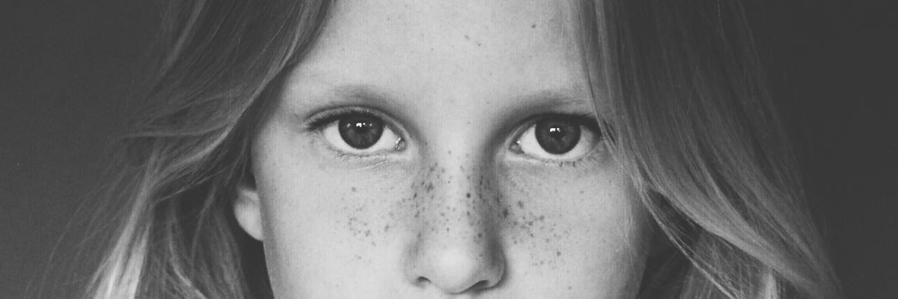 When My Childhood Teacher Punished Me for My Trichotillomania black and white photo of young girl with blonde hair looking into camera