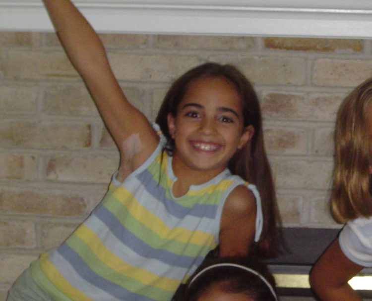 the author when she was young, showing her vitiligo spots under her arm