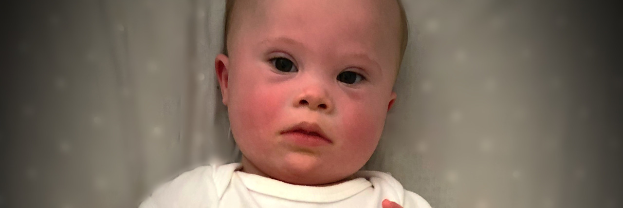 Responding to the Doctor Who Didn't Value My Child With Down Syndrome AD's infant son who has Down syndrome.