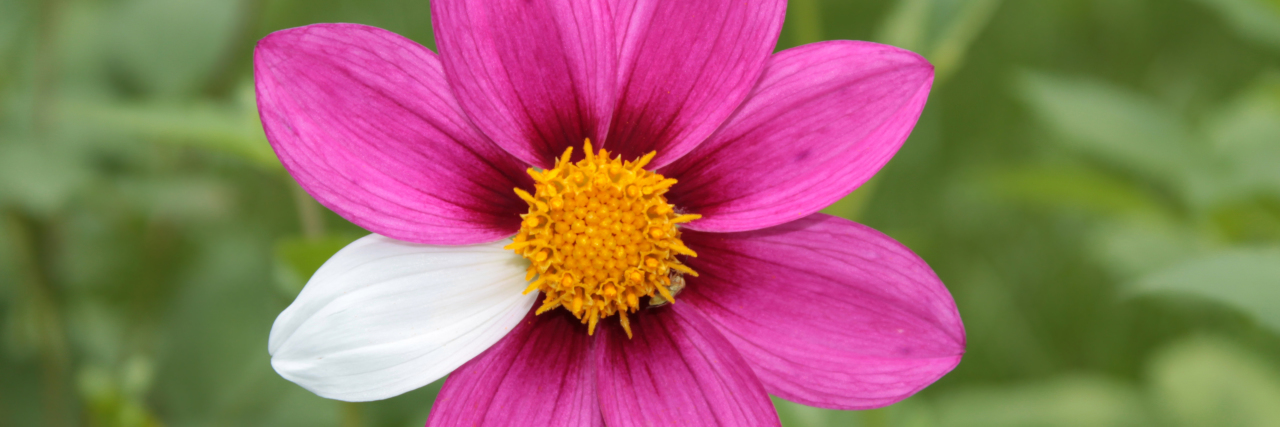 5 Things to Know About the Rare Disease Community Pink flower with one white petal.
