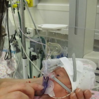 Premature baby in the NICU.