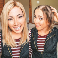 Side by side of a woman with shoulder-length blonde hair (a wig) and her without her wig