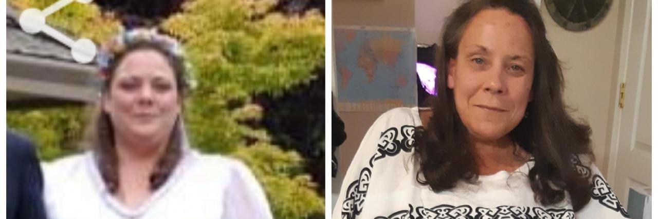 How Illness, Hospitalization and Disability Changed Me Jennifer before and after she became disabled.