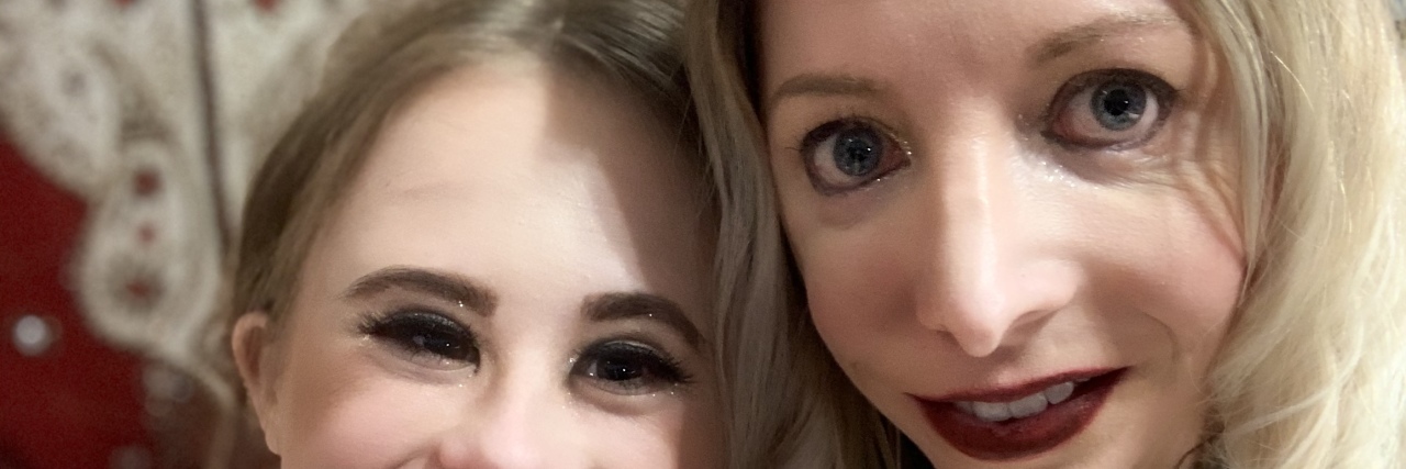 Moving Beyond Plastic Surgery in Life With Treacher Collins Syndrome Cynthia Cherise Murphy with Down syndrome Model Abigail Adams