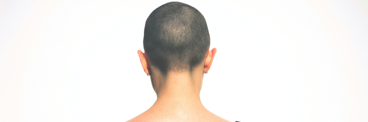 The back of a bald woman's head