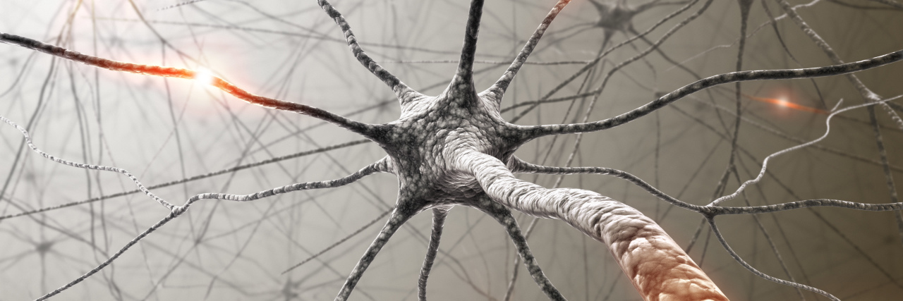 Describing the Cessation of Pain black and white neuron