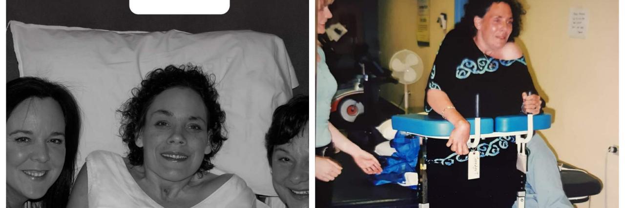 'Giving In' After Becoming Disabled Is Not the Same as 'Giving Up' Pictures of Jennifer's progress after becoming disabled.