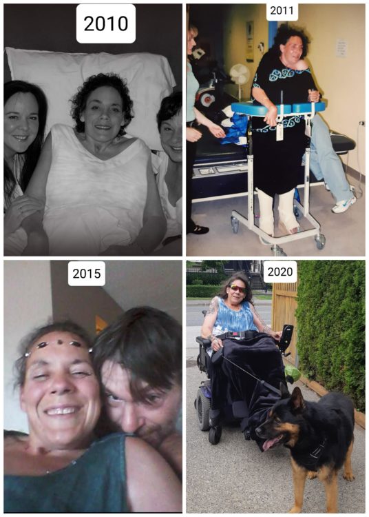 Pictures of Jennifer's progress after becoming disabled.