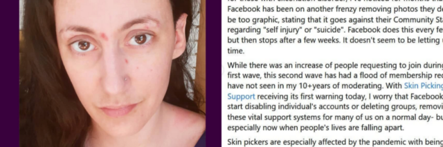 on the left: a photo of the author with scars on her face. On the right: a Facebook post