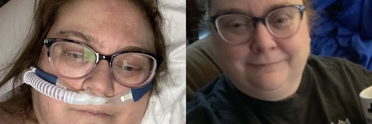 I Survived COVID-19 but I'm Still Experiencing Symptoms On the left, the author lying in her hospital bed. On the right, the author at home, smiling