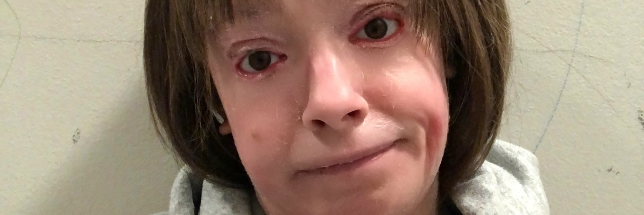 Why You Should Be Kind to People Living With Pain