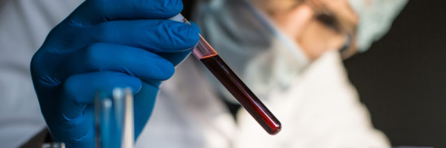 Researcher looking at blood sample in test tube.