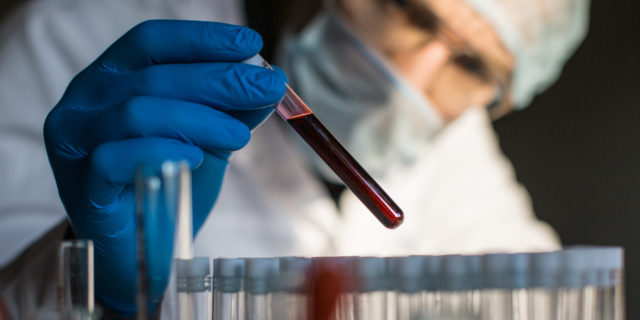How Unknown Chronic Illness Can Make Bad News Into Good News Researcher looking at blood sample in test tube.