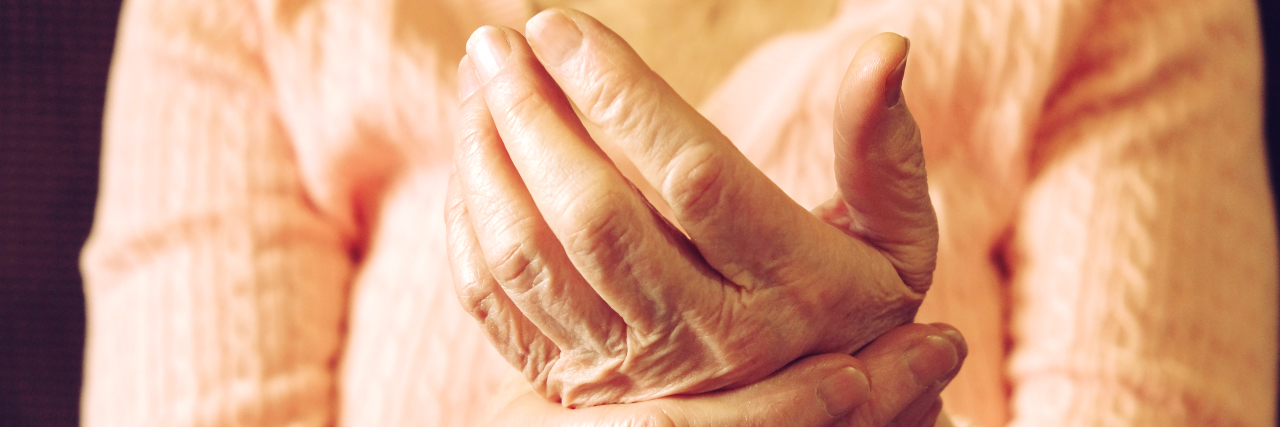 Living With Chronic Hand Pain From Arthritis Mature woman's hands.