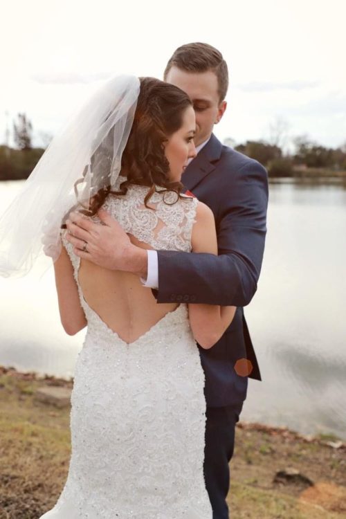 Karina's wedding photo in which her back scar is visible.