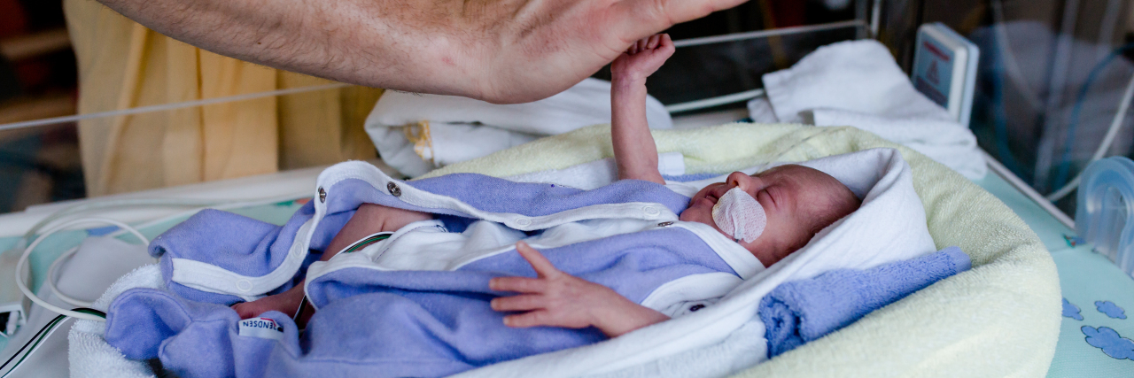The Problem With Saying, 'As Long as the Baby Is Healthy' Premature baby in NICU