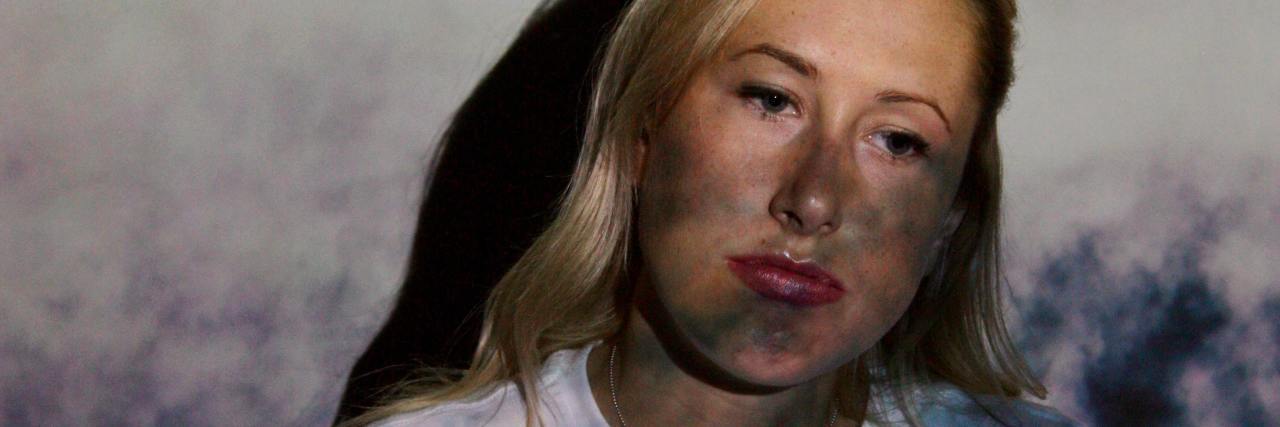 How 'Reactive Depression' Can Sneak Up on You photo of a woman standing against a wall with image of clouds projected onto her face