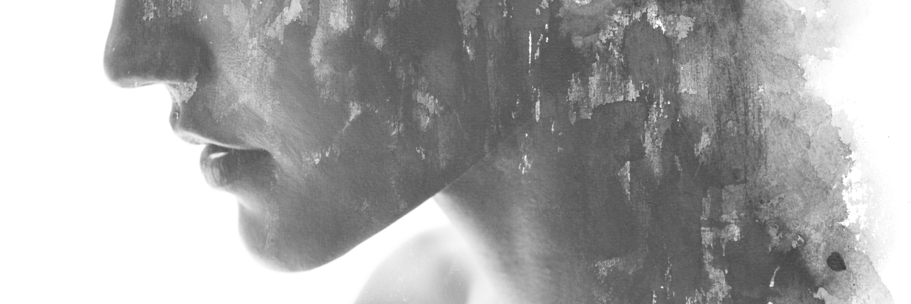 How Self-Harm Can Be an OCD Compulsion black and white image of a woman's profile