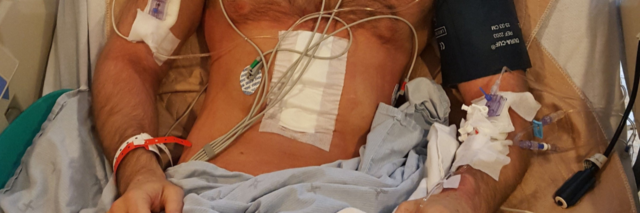 photo of author post-surgery, a white man's chest in a hospital bed with wires and tubes everywhere