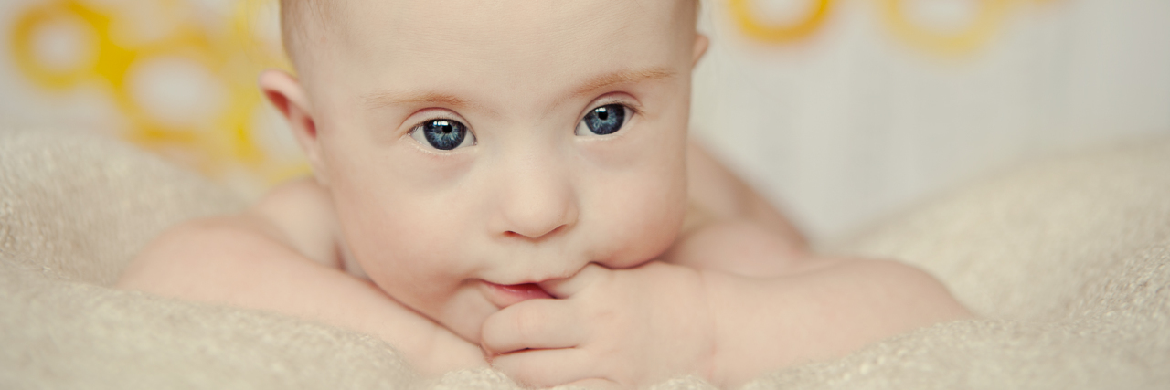 Supporting New Parents of a Baby With Down Syndrome Baby girl with Down syndrome