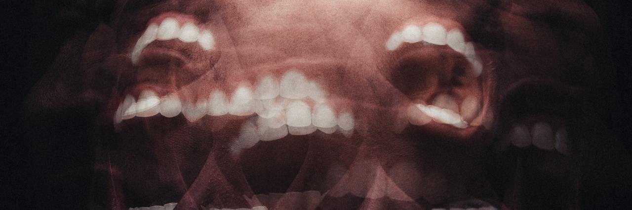 People With Mental Health Conditions Are Allowed to Be Angry Man being angry