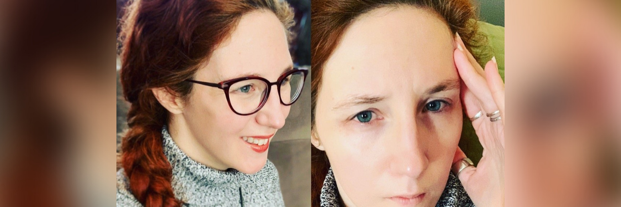 Two photos of contributor: one showing her smiling, the other she is holding her head in pain