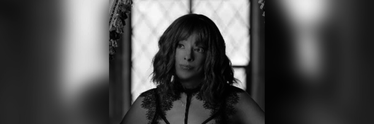 Why I'm Proudly Wearing Shorts This Summer as Someone With Ichthyosis Francine wearing lingerie.