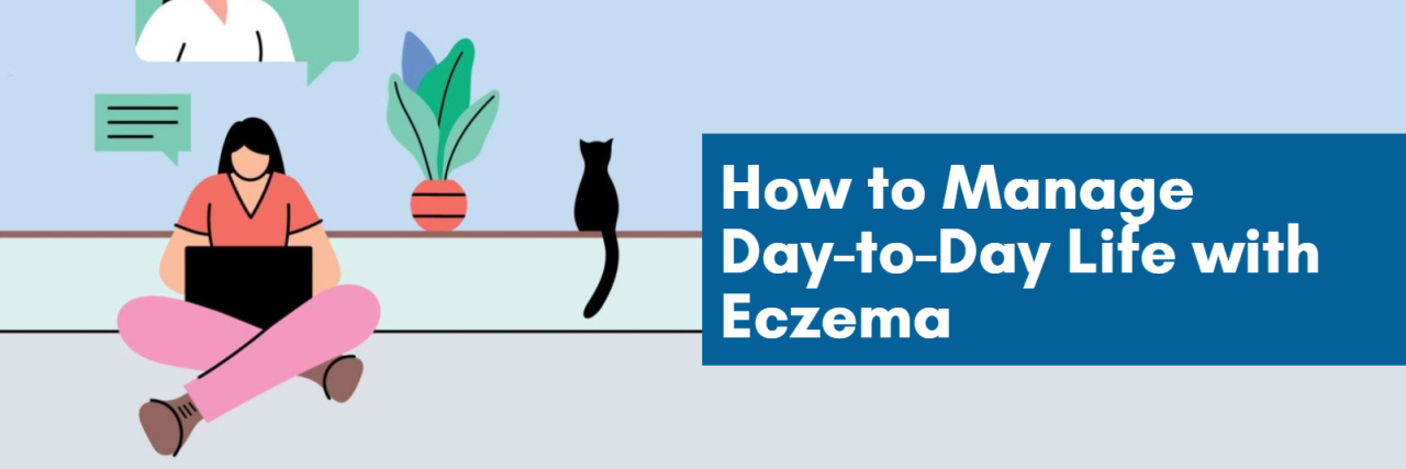 How to Manage Day-to-Day Life With Eczema