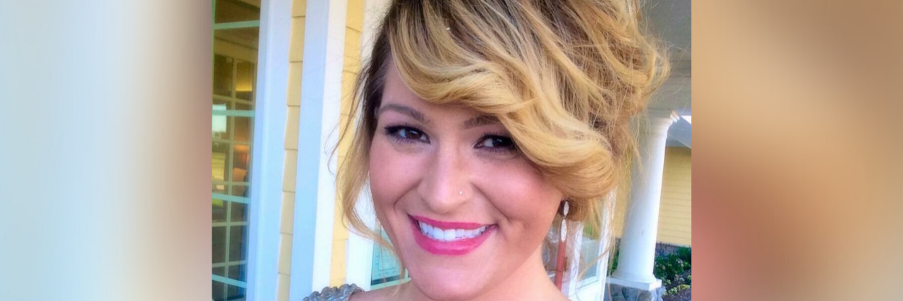 The Challenges of Living With Psoriasis Photo of the writer smiling at the camera