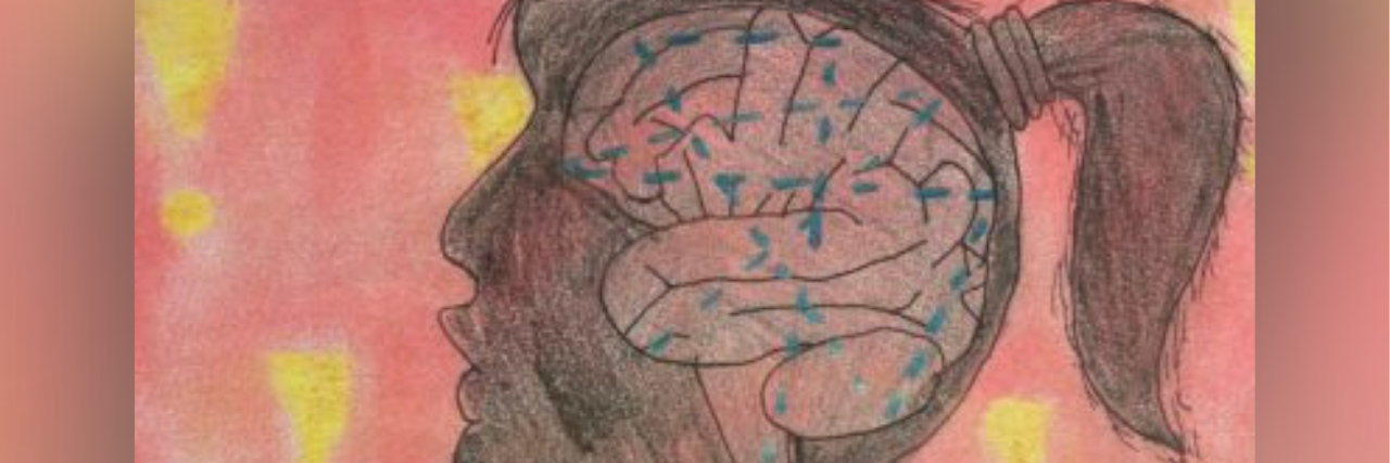 My Nephew's Surgery Helped My Healing Process With Medical Trauma Sketch of a woman's head with a brain inside