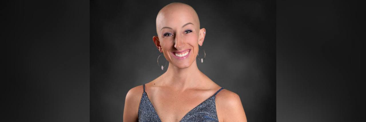Why Losing My Hair to Alopecia Was the Best Thing to Happen to Me Lindsay, a woman with alopecia who is bald and wearing a blue dress.