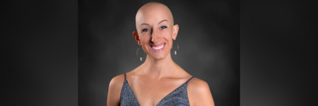 Lindsay, a woman with alopecia who is bald and wearing a blue dress.